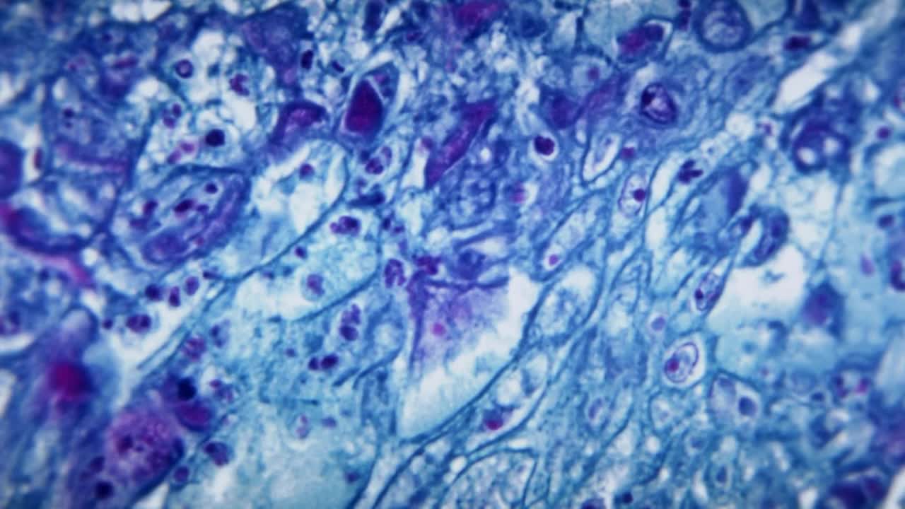 Monkeypox Declared A Public Health Emergency