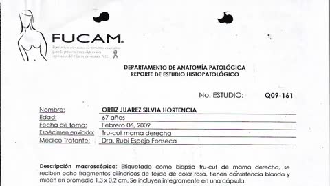 Cáncer de mama sin quimioterapia