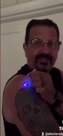 Guys arm and vein glows from the jab (Language alert)