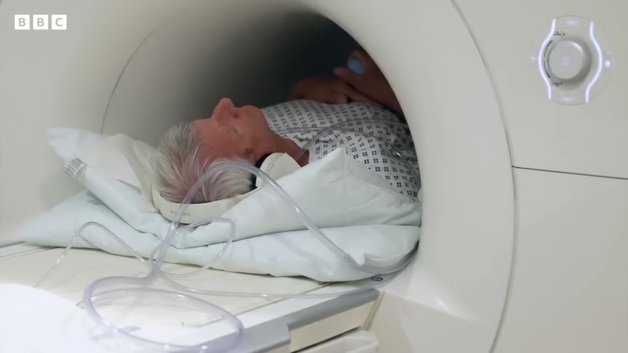 Can MRI scans screen man for prostate canser _ bbc news