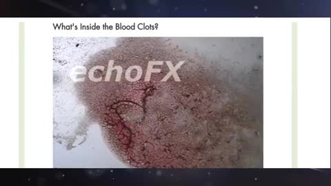 Dr. Robert Young's COVID Shot Finding: Nanoparticles So Tiny They Shut Down Your Consciousness