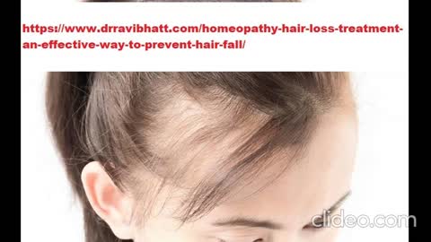 hair loss treatment