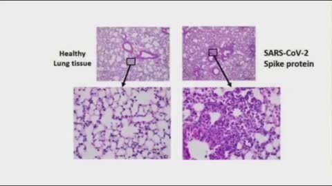 Ryan Cole - Spike protein je toxin