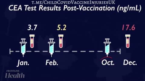 Elevated CEA and cancer after Covid Vaccine