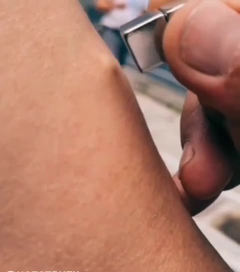 DEATH VAX YOU CAN SEE IT MOVE UNDER THE SKIN