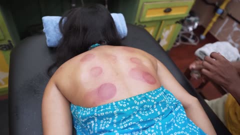 Master Cracker Back Cupping Massage for Pain Relief _ Indian Massage