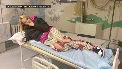 Ukraine's youngest victims of war