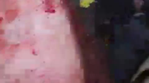 US MERCENARIES UKRAINE INJURED