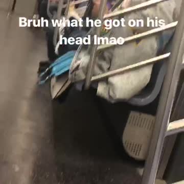Bruh what he got on his head lmao
