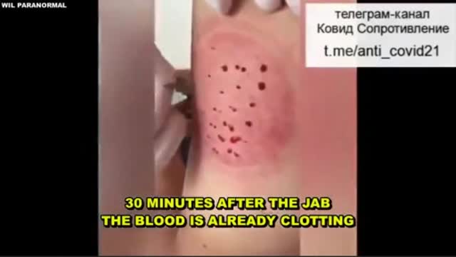 C0\/lD JAB Does This To Your Blood