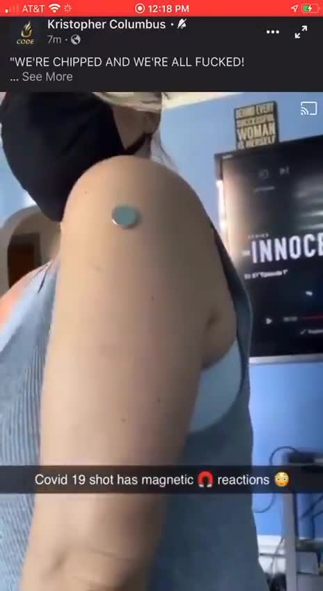 i nuovi microchip sulla pelle