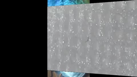 Morgellons In Masks? 마스크에 모겔론스가?