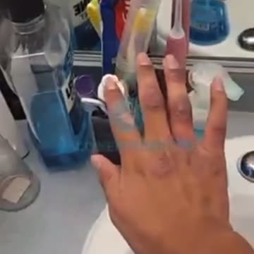 This guy’s skin is a mess after receiving the death shot.