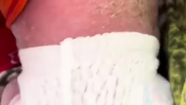 Một cậu bé thật đáng thương khi mắc bệnh hiểm gặp!