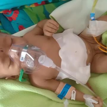 Help Baby Get A Second Chance At Life / This Baby Is Battling Between Life And Death