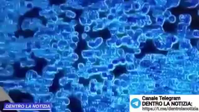 Problemi nel sangue di una bambina vaccinata