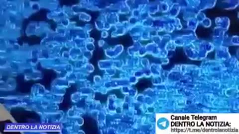 Problemi nel sangue di una bambina vaccinata