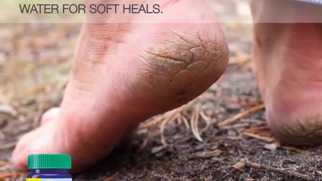 Amazing Alternative Uses For Vaporub