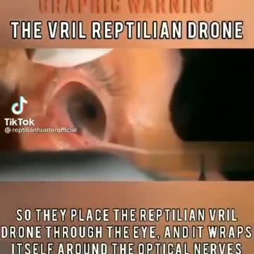 Vril Mouth They're suckers, this explains elite "black eyes"~!