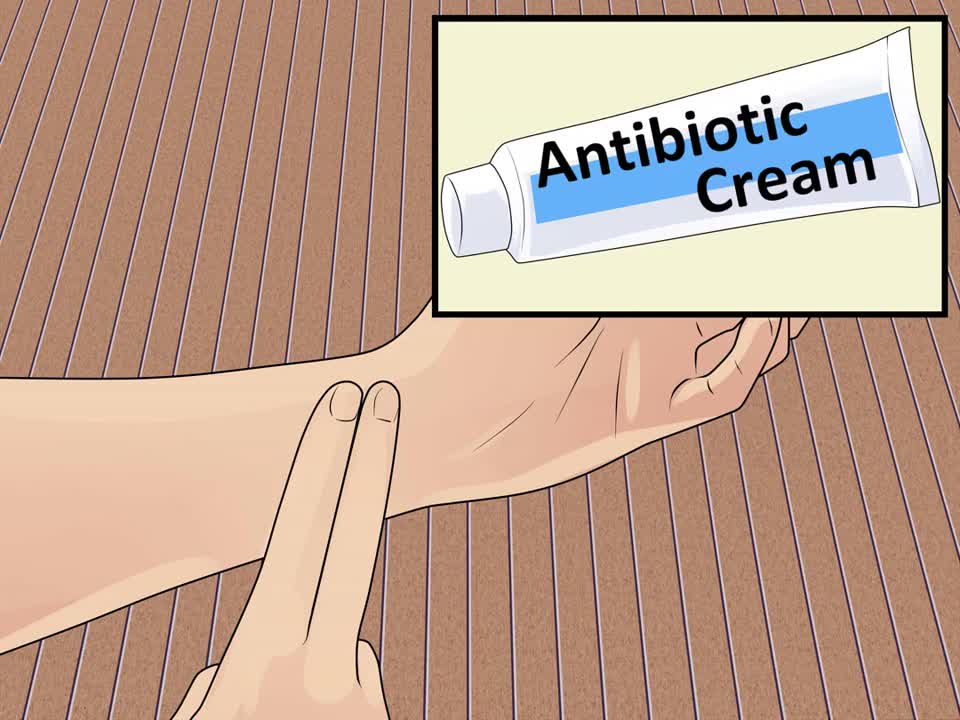 Tips to treat a Cat Bite