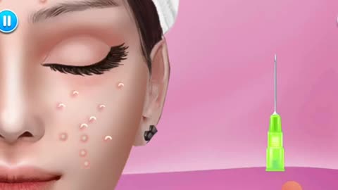 ASMR Acne & Black Head Pimple Removal - Acne Deep Cleaning Animation