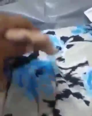 Alte "Covid" Patienten Behandlung in Brasilien