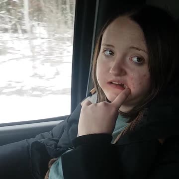 Wisdom teeth out and all doped up lol