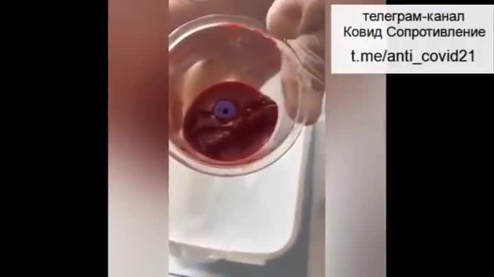 DID YOU SEE LOOK BLOOD