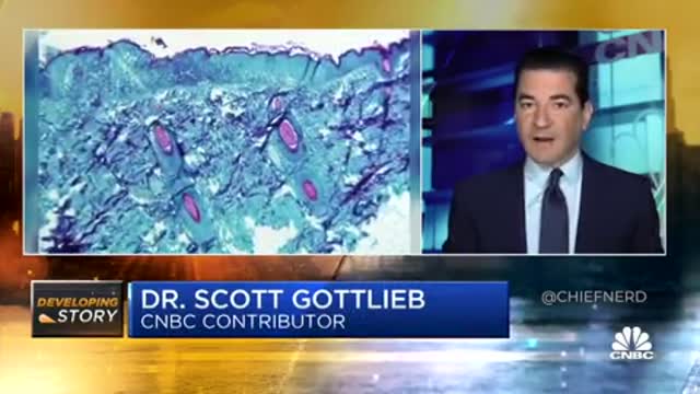 Dr. Scott Gottlieb Says Monkeypox is "Super Stable