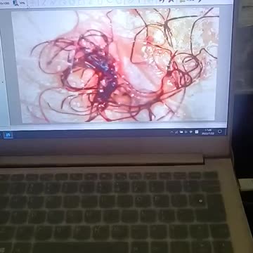 Naukowcy zbadali ludzi po szczepionkach na nievida-19 (opis czytaj)