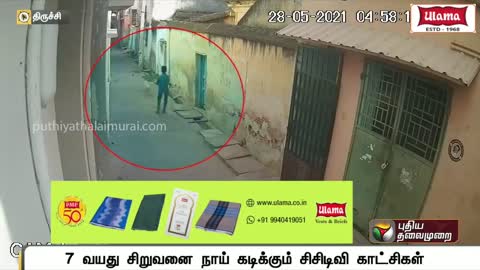 7 வயது சிறுவனை நாய் கடிக்கும் சிசிடிவி காட்சி..! | Trichy | CCTV Footage