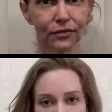 😍Women rejuvenated by surgery in South Korea #interestingfacts #shortvideo