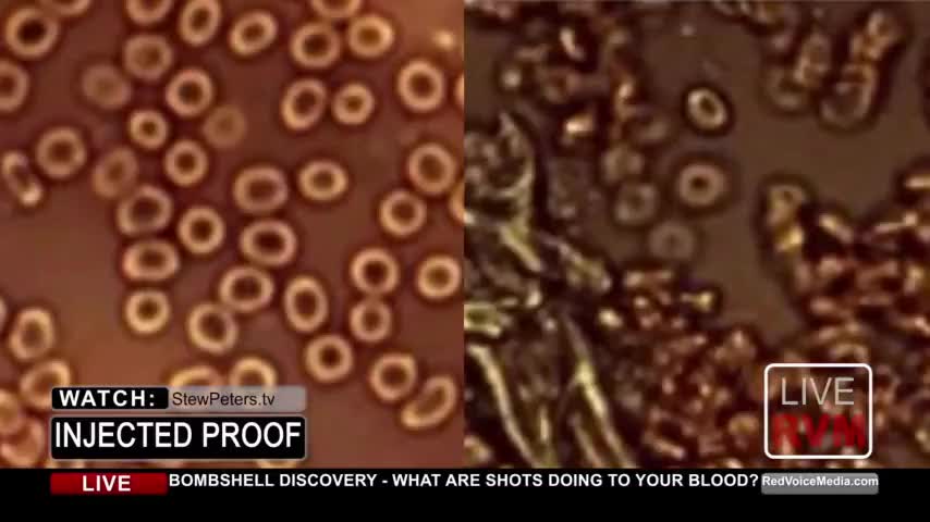 Dr.Jane Ruby: INJECTED PROOF !!! WHAT ARE SHOTS DOING TO YOUR BLOOD??? BOMBSHELL !!!