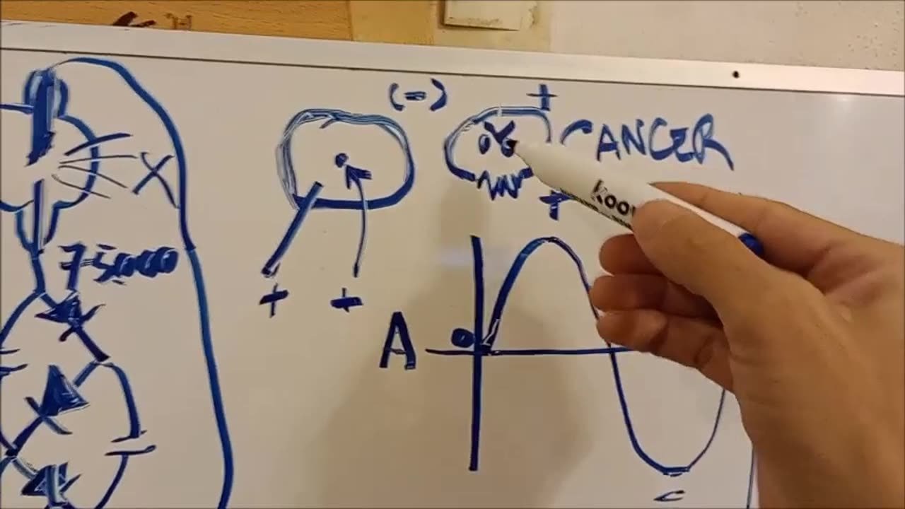 Linac DC for cancer