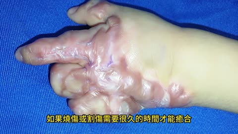 身體8跡象 免疫力下降！