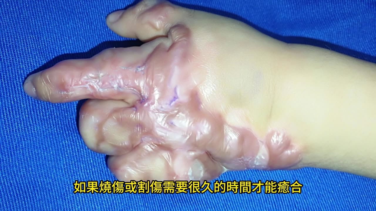 身體8跡象 免疫力下降!