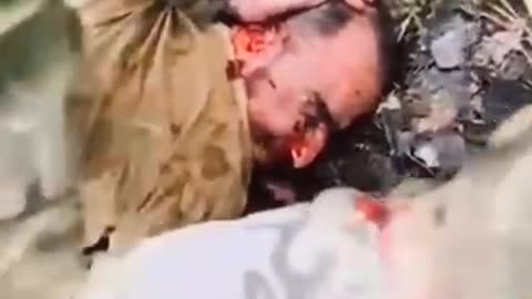 what happened to this Zionist faggot's ear? (Watch next video)