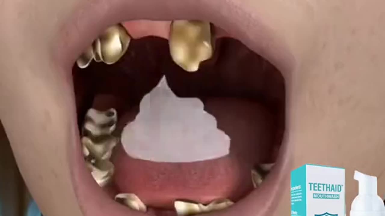 deep cleaning teeth