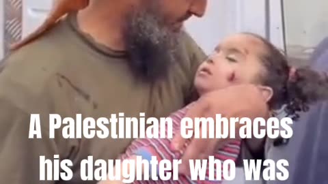 A Palestinian embraces his daughter who was killed by the Israeli bombing.