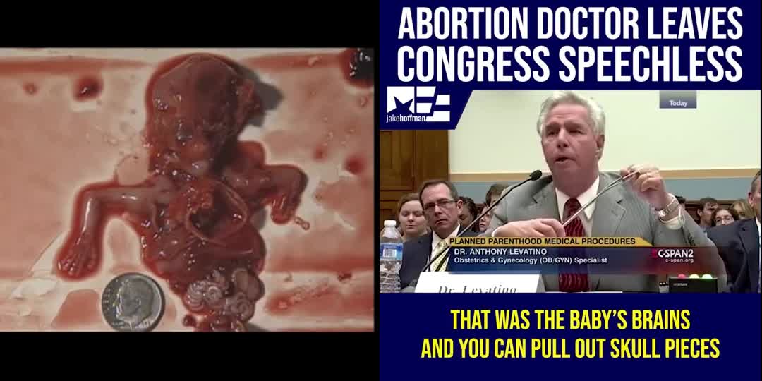 Doctor Explains how an abortion is done