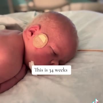 Powerful Truth: born, healthy 34-wk baby video with audio description of 34-wk abortion
