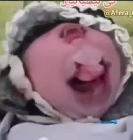 Apparently This is the result of a Gene Drive! I guess both parents were fully vaccinated!