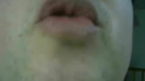Recoupment