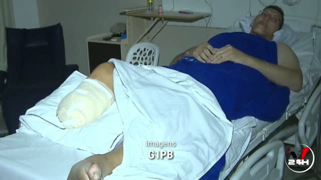 APÓS CIRURGIA PARA AMPUTAR PERNA, NINÃO ESPERA VOLTAR A ANDAR E MELHORAR A QUALIDADE DE VIDA