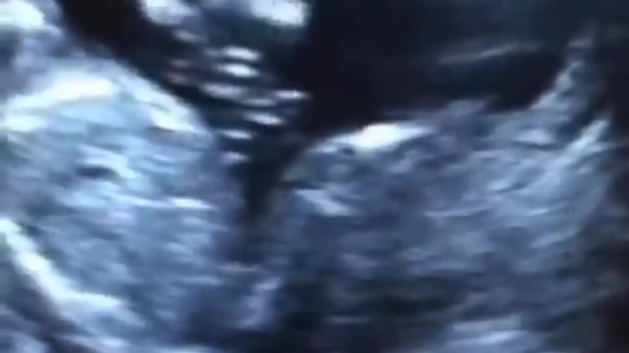 Joseph Martelli jjm7777 Baby before birth and after birth