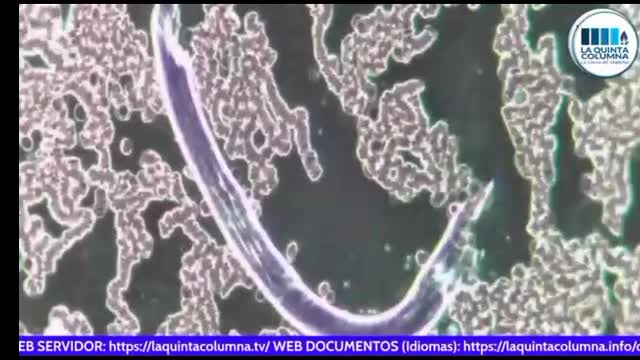 5G Strange looking globes (spheres of different dimensions) found in the Pfizer vaccine