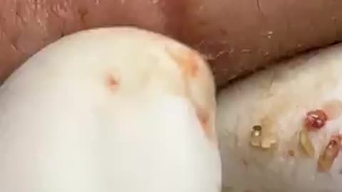 Remove obstacles from seck/ Remove dark spots.