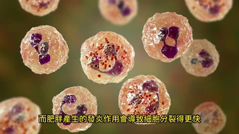 變胖增腸胃癌風險！ 兩個年齡層最危險