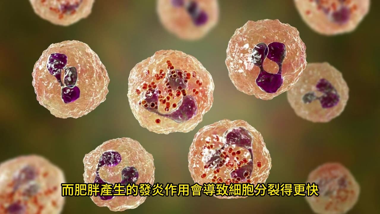 變胖增腸胃癌風險! 兩個年齡層最危險