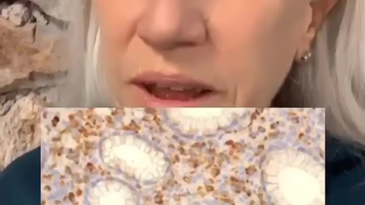 Spike-Proteine innerhalb der Krebszellen